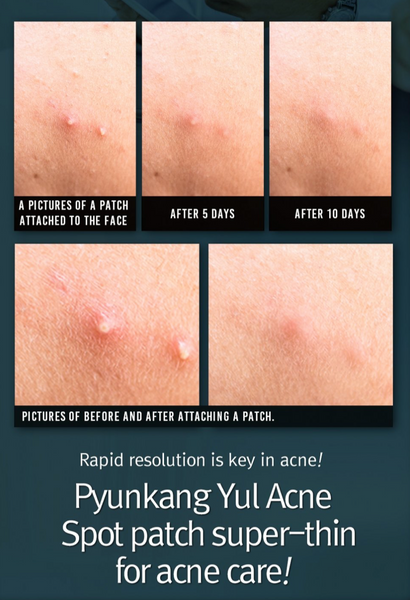 Pyunkang Yul - ACNE Spot Patch Super Thin (15 Patches)